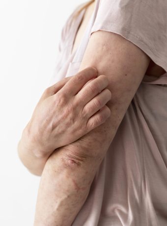 skin allergy - sakethskincare